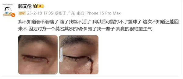 陶勇医生谈郭艾伦眼睛缝40多针：不会影响运动生涯