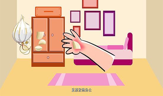 蚊子咬了怎么消肿止痒最快