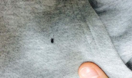 衣服染墨水怎么洗掉